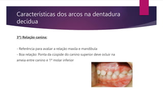 Características dos arcos na dentadura
decídua
3º) Relação canina:
- Referência para avaliar a relação maxila e mandíbula
- Boa relação: Ponta da cúspide do canino superior deve ocluir na
ameia entre canino e 1º molar inferior
 
