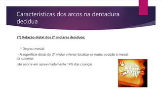 Características dos arcos na dentadura
decídua
7º) Relação distal dos 2º molares decíduos:
* Degrau mesial:
- A superfície distal do 2º molar inferior localiza-se numa posição à mesial
da superior.
Isto ocorre em aproximadamente 14% das crianças
 