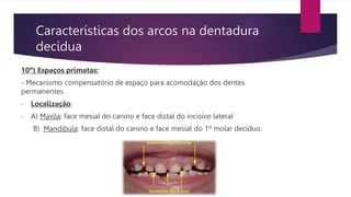 Características dos arcos na dentadura
decídua
10º) Espaços primatas:
- Mecanismo compensatório de espaço para acomodação dos dentes
permanentes.
- Localização:
- A) Maxila: face mesial do canino e face distal do incisivo lateral
B) Mandibula: face distal do canino e face mesial do 1º molar decíduo.
 