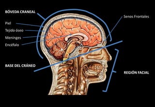 BÓVEDA CRANEALSenos FrontalesPielTejido óseoMeningesEncéfaloBASE DEL CRÁNEOREGIÓN FACIAL