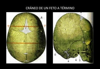CRÁNEO DE UN FETO A TÉRMINO