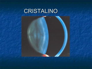 CRISTALINO
 