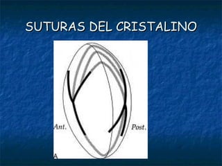 SUTURAS DEL CRISTALINO
 