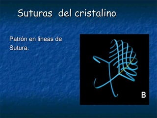 Suturas del cristalino

Patrón en lineas de
Sutura.
 
