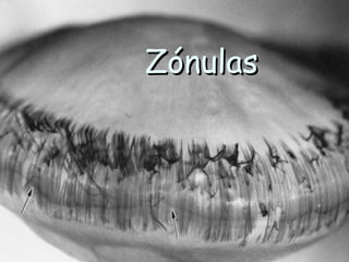 Zónulas
 