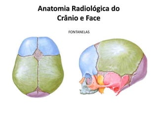 Anatomia Radiológica do
Crânio e Face
FONTANELAS
 