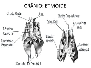 CRÂNIO: ETMÓIDE
 