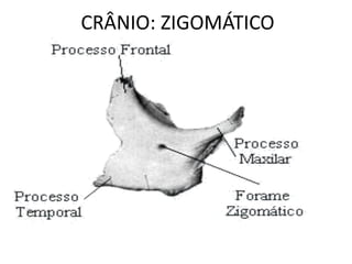 CRÂNIO: ZIGOMÁTICO
 