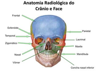 Anatomia Radiológica do
Crânio e Face
Frontal
Parietal
Lacrimal
Maxila
Mandíbula
Vômer
Nasal
Zigomático
Temporal
Esfenóide
Concha nasal inferior
 