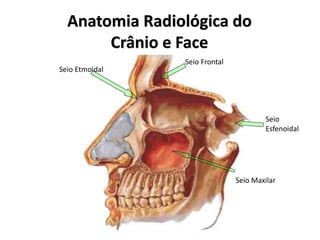 Anatomia Radiológica do
Crânio e Face
Seio Frontal
Seio
Esfenoidal
Seio Maxilar
Seio Etmoidal
 