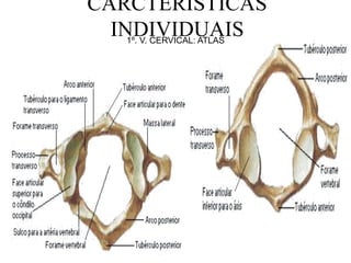 CARCTERÍSTICAS
INDIVIDUAIS1º. V. CERVICAL: ATLAS
 