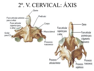 2º. V. CERVICAL: ÁXIS
 