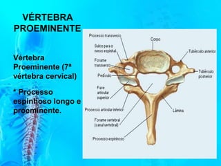 VÉRTEBRA
PROEMINENTE
Vértebra
Proeminente (7ª
vértebra cervical)
* Processo
espinhoso longo e
proeminente.
 