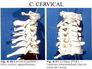 C. CERVICAL
 