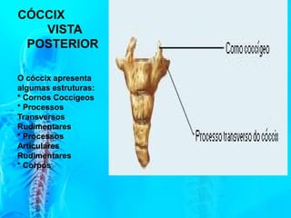 CÓCCIX
VISTA
POSTERIOR
O cóccix apresenta
algumas estruturas:
* Cornos Coccígeos
* Processos
Transversos
Rudimentares
* Processos
Articulares
Rudimentares
* Corpos
 