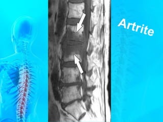 Anatomia c vertebral   2016