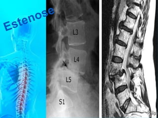 Anatomia c vertebral   2016