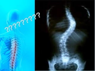 Anatomia c vertebral   2016
