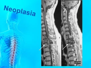 Anatomia c vertebral   2016