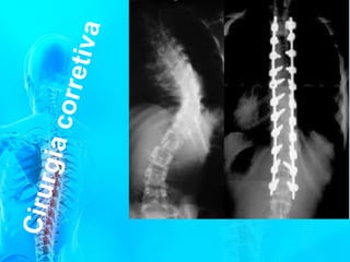 Anatomia c vertebral   2016