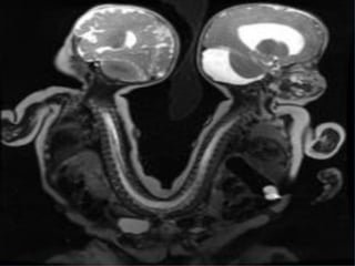 Anatomia c vertebral   2016
