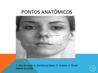  

PONTOS ANATÔMICOS 

1- Asa do nariz; 2- Comissura labial; 3- Acântio; 4- Borda
lateral da orbita.

15

 