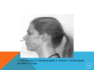 1- Asa do nariz; 2- Comissura labial; 3- Acântio; 4- Borda lateral
da orbita; 5- Trago.

16

 