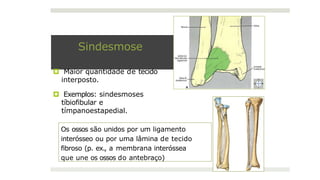 Sindesmose
🞑 Maior quantidade de tecido
interposto.
🞑 Exemplos: sindesmoses
tíbiofibular e
tímpanoestapedial.
Os ossos são unidos por um ligamento
interósseo ou por uma lâmina de tecido
fibroso (p. ex., a membrana interóssea
que une os ossos do antebraço)
 