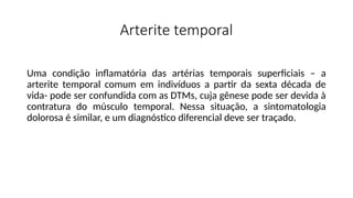 Arterite temporal
Uma condição inflamatória das artérias temporais superficiais – a
arterite temporal comum em indivíduos a partir da sexta década de
vida- pode ser confundida com as DTMs, cuja gênese pode ser devida à
contratura do músculo temporal. Nessa situação, a sintomatologia
dolorosa é similar, e um diagnóstico diferencial deve ser traçado.
 