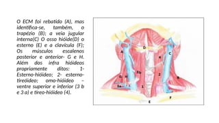 O ECM foi rebatido (A), mas
identifica-se, também, o
trapézio (B); a veia jugular
interna(C) O osso hióide(D) o
esterno (E) e a clavícula (F);
Os músculos escalenos
posterior e anterior- G e H.
Além dos infra hióideos
propriamente ditos: 1-
Esterno-hióideo; 2- esterno-
tireóideo; omo-hióideo –
ventre superior e inferior (3 b
e 3 a) e tireo-hióideo (4).
 