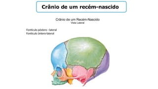 Crânio de um recém-nascido
Fontículo póstero –lateral
Fontículo ântero-lateral
 