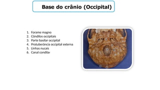 Base do crânio (Occipital)
1. Forame magno
2. Côndilos occipitais
3. Parte basilar occipital
4. Protuberância occipital externa
5. Linhas nucais
6. Canal condilar
 