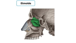 Etmoide
 