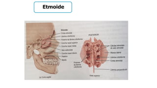 Etmoide
 