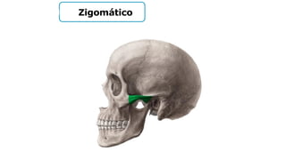 Zigomático
 