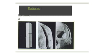 Escamos
a
Suturas
 