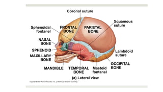 Sphenoidal
fontanel
NASAL
BONE
SPHENOID
MAXILLARY
BONE
MANDIBLE TEMPORAL
BONE
Mastoid
fontanel
Lateral view
OCCIPITAL
BONE
Lambdoid
suture
Squamous
suture
PARIETAL
BONE
FRONTAL
BONE
Coronal suture
 