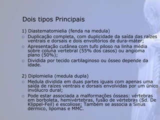 1) Diastematomielia (fenda na medula)
 Duplicação completa, com duplicidade da saída das raízes
ventrais e dorsais e dois envoltórios de dura-máter;
 Apresentação cutânea com tufo piloso na linha média
sobre coluna vertebral (55% dos casos) ou angioma
plano (50%);
 Dividida por tecido cartilaginoso ou ósseo depende da
idade.
2) Diplomielia (medula dupla)
 Medula dividida em duas partes iguais com apenas uma
saída de raízes ventrais e dorsais envolvidas por um único
invólucro dural;
 Pode estar associada a malformações ósseas: vértebras
em borboleta, hemivértebras, fusão de vértebras (Sd. De
Klippel-Feil) e escoliose; Também se associa a Sinus
dérmico, lipomas e MMC.
Dois tipos Principais
 