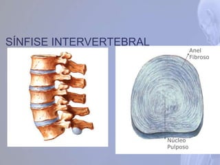 SÍNFISE INTERVERTEBRAL
Núcleo
Pulposo
Anel
Fibroso
 