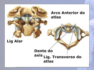 Dente do
axis
Arco Anterior do
atlas
Lig. Transverso do
atlas
Lig Alar
 