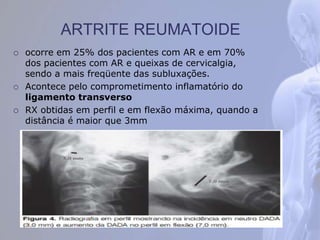 ARTRITE REUMATOIDE
 ocorre em 25% dos pacientes com AR e em 70%
dos pacientes com AR e queixas de cervicalgia,
sendo a mais freqüente das subluxações.
 Acontece pelo comprometimento inflamatório do
ligamento transverso
 RX obtidas em perfil e em flexão máxima, quando a
distância é maior que 3mm
 