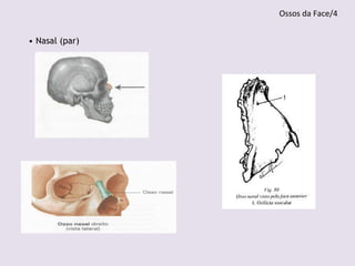 • Nasal (par)
Ossos da Face/4