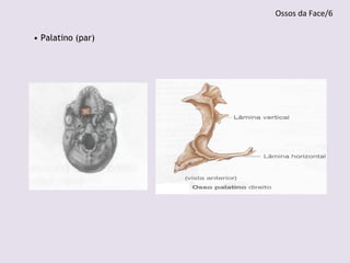 • Palatino (par)
Ossos da Face/6