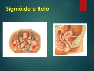 Sigmóide e Reto
 