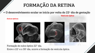 FORMAÇÃO DA RETINA
O desenvolvimento ocular se inicia por volta do 22º dia de gestação
Formação do sulco óptico 22° dia.
Entre o 22º e o 30º dia, ocorre a formação da vesícula óptica.
 