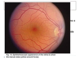    Na mácula existem alguns pigmentos que protegem a
    retina contra a oxidação
   Na fóvea, região responsável pela alta definição de cores e
    formas, a espessura é mais fina
   A fovéola é o centro da fóvea, e é uma região rica em
    cones e sem vascularização. Por isso depende da coróide
    para sua nutrição
 