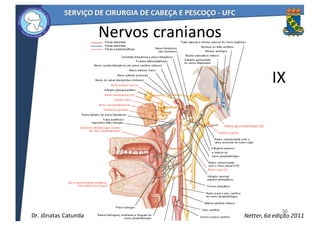 32
Netter,	6a	edição	2011
Nervos	cranianos
IX
32
Dr.	Jônatas	Catunda
 