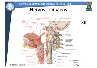 35
XII
Nervos	cranianos
Dr.	Jônatas	Catunda
 