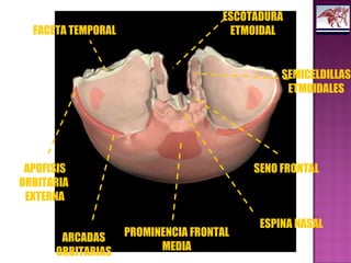 ESCOTADURA
ETMOIDAL
SEMICELDILLAS
ETMOIDALES
SENO FRONTAL
ESPINA NASAL
PROMINENCIA FRONTAL
MEDIA
ARCADAS
ORBITARIAS
APOFISIS
ORBITARIA
EXTERNA
FACETA TEMPORAL
 