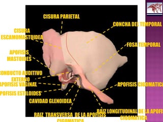 CISURA PARIETAL
CONCHA DEL TEMPORAL
FOSA TEMPORAL
APOFISIS CIGOMATICA
RAIZ LONGITUDINAL DE LA APOFIS
CIGOMATICA
RAIZ TRANSVERSA DE LA APOFISIS
CAVIDAD GLENOIDEA
POFISIS ESTILOIDES
APOFISIS VAGINAL
CONDUCTO AUDITIVO
EXTERNO
APOFISIS
MASTOIDES
CISURA
ESCAMOMASTOIDEA
 